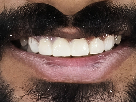 Before